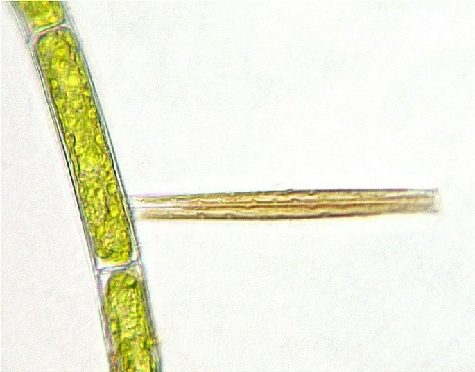 The green alga (Conjugatophyceae) with perpendicularly attached diatoms