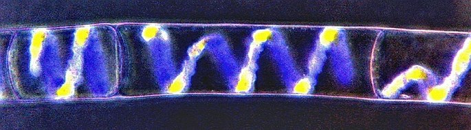 The green alga of Spirogyra genus