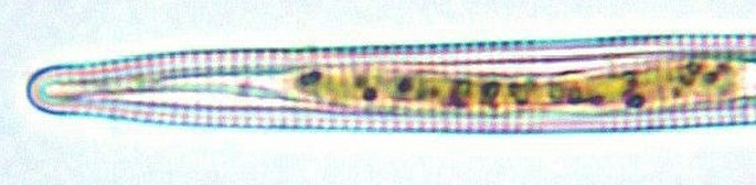 Different individuals of the diatoms species