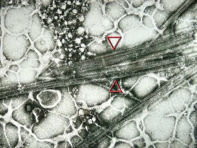 Bundles of cytoskeletal microtubules