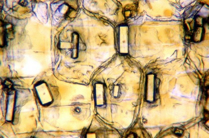 Cells from the outer onion leaf containing crystals of calcium oxalate