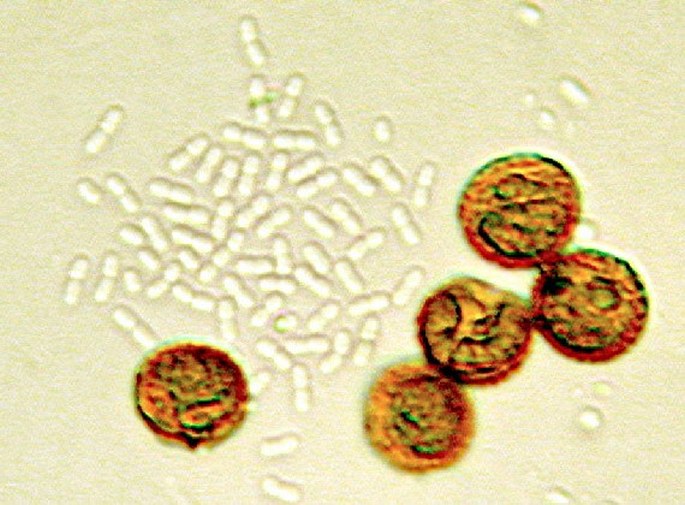 A small bacterial colony accompanying brown colored spores of a slime mould