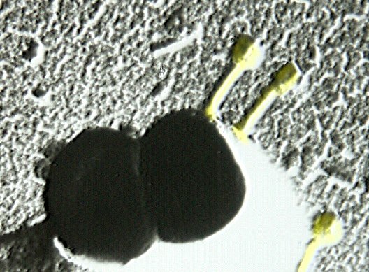 Bacteriophages attached to a staphylococcus