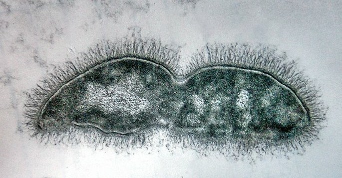 An ultrathin section through a bacteria