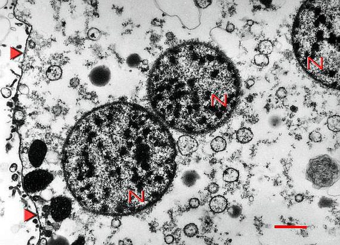 plasmodial slime molds under microscope