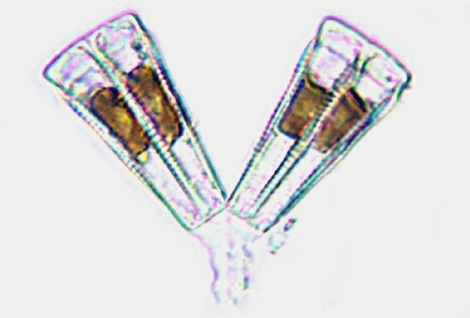 Different individuals of the diatoms species