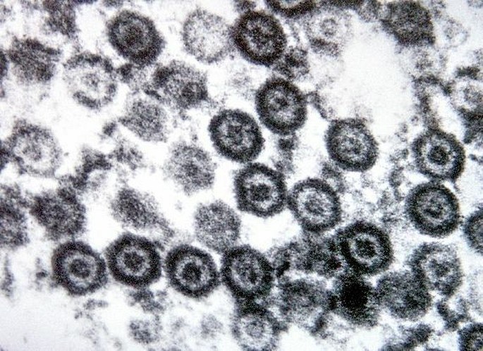 Herpes viruses