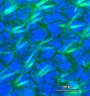 Mikroskopický fluorescenční snímek detailu pasti bublinatky jižní: svítí čtyřramenné žlázky vylučující fosfatázy